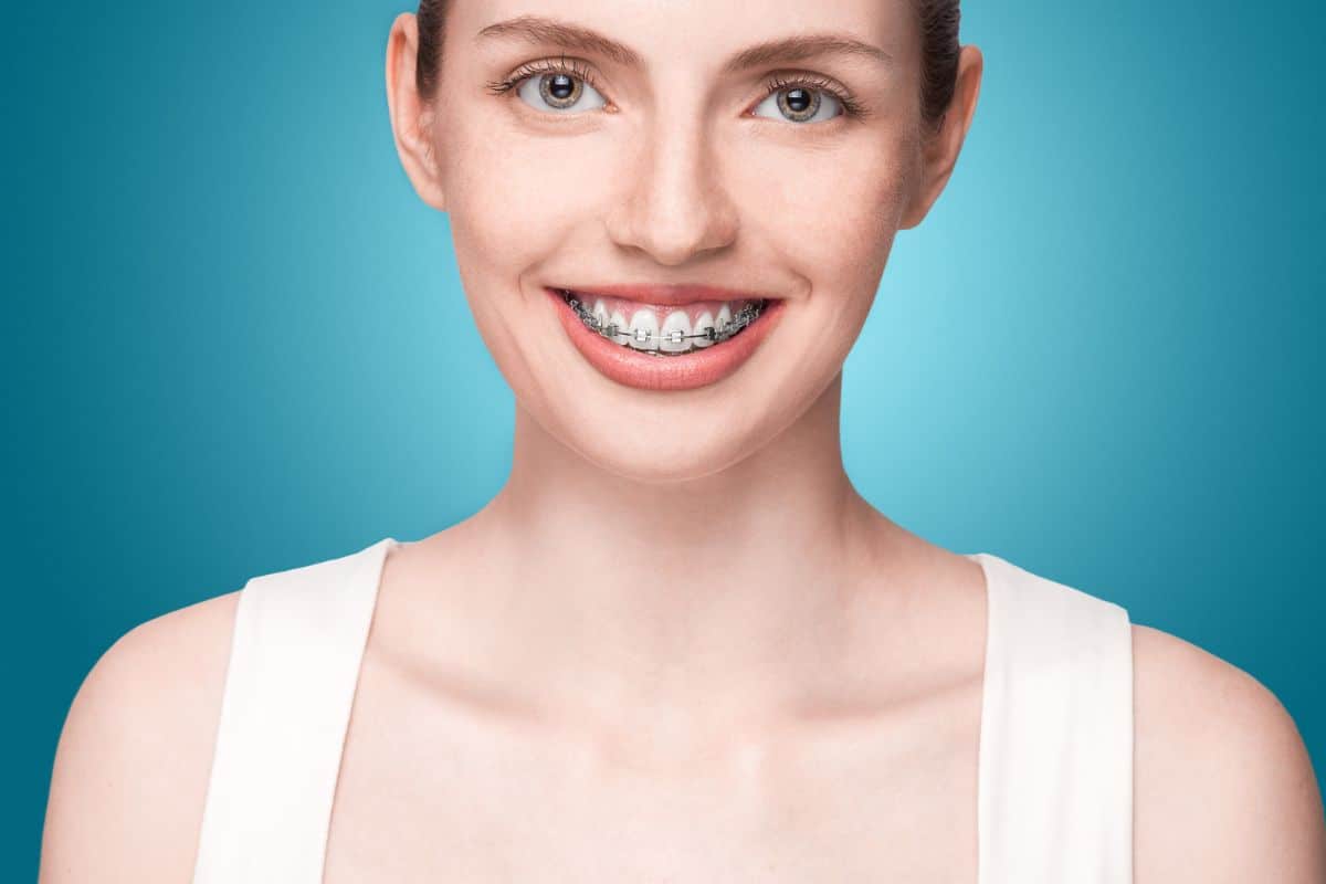 Woman smiling with braces
