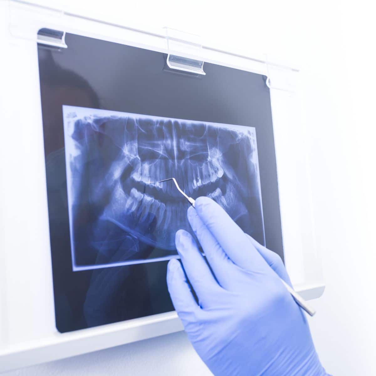 Dentist reviewing a patient's dental xray